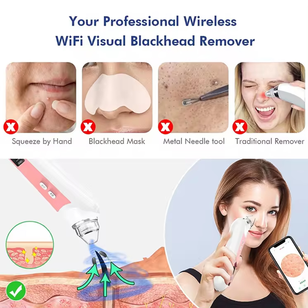 6 Heads Pore Cleaner Blackhead - Pore Vacuum review and price