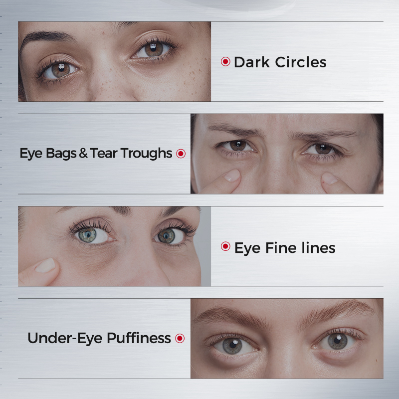 Eye Patches for Dark Circles – - Collagen Eye Patch review and price