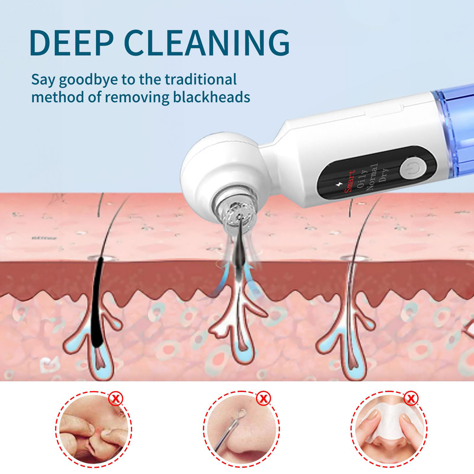 Blackhead Remover Pore Vacuum  - Pore Vacuum review and price