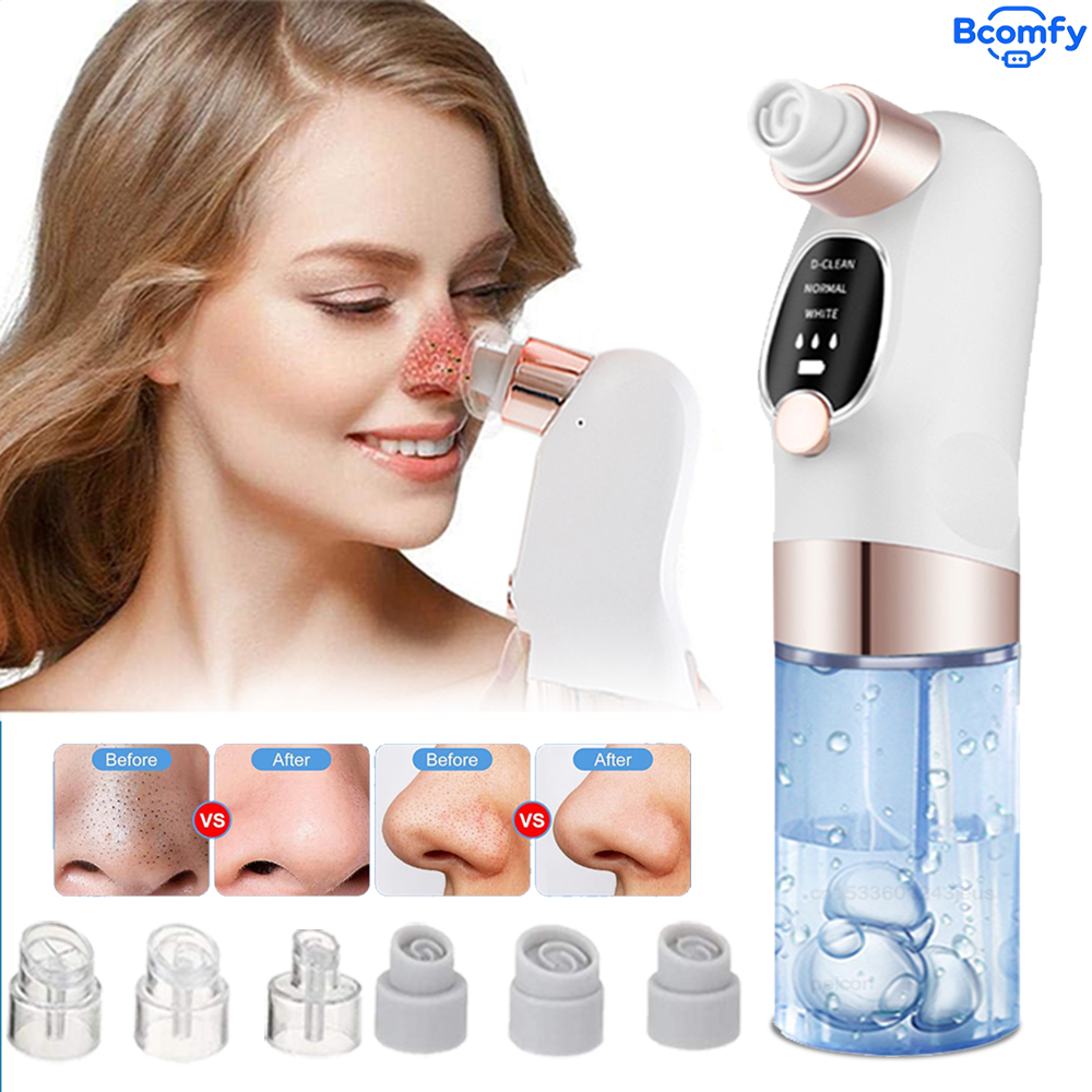 Electric Blackhead Remover Vac - Pore Vacuum review and price