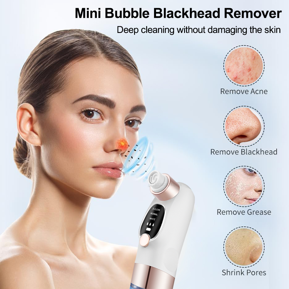 Electric Blackhead Remover Vac - Pore Vacuum review and price