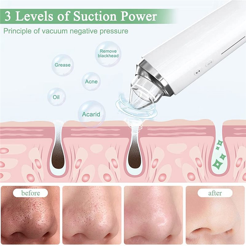 【FITTING】Blackhead Remover Por - Pore Vacuum review and price