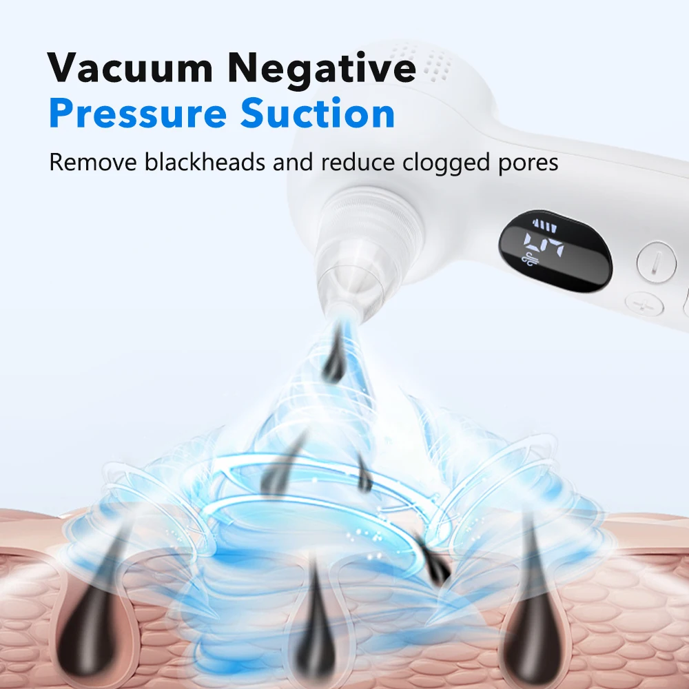 Blackhead Remover Pore Vacuum  - Pore Vacuum review and price