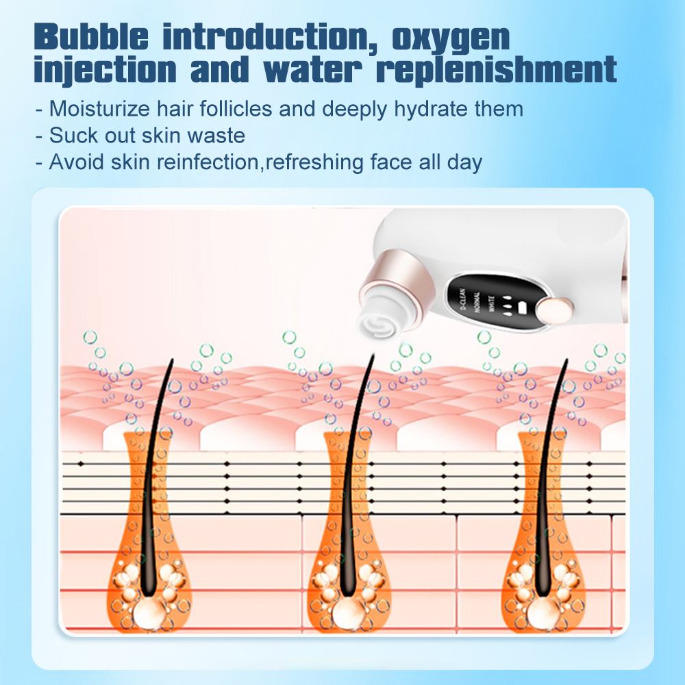 Electric Blackhead Remover Por - Pore Vacuum review and price
