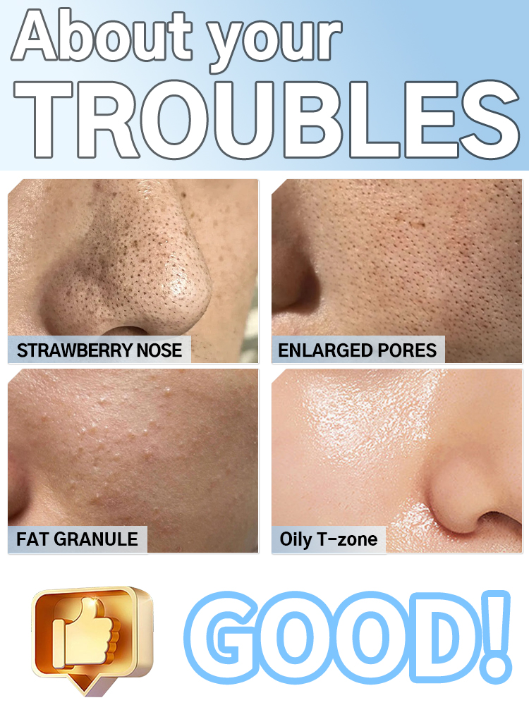 Electric Facial Pore Cleaner B - Pore Vacuum review and price