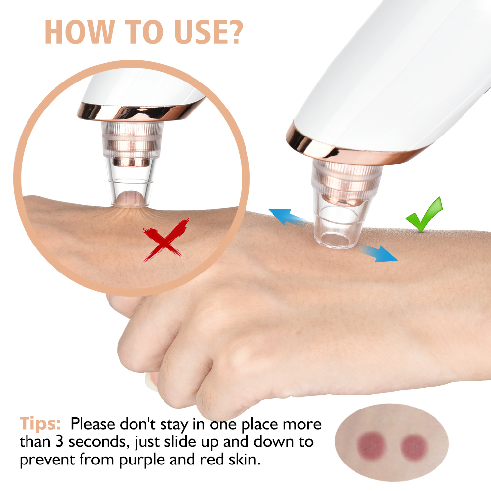 Blackhead Remover Vacuum Pore  - Pore Vacuum review and price