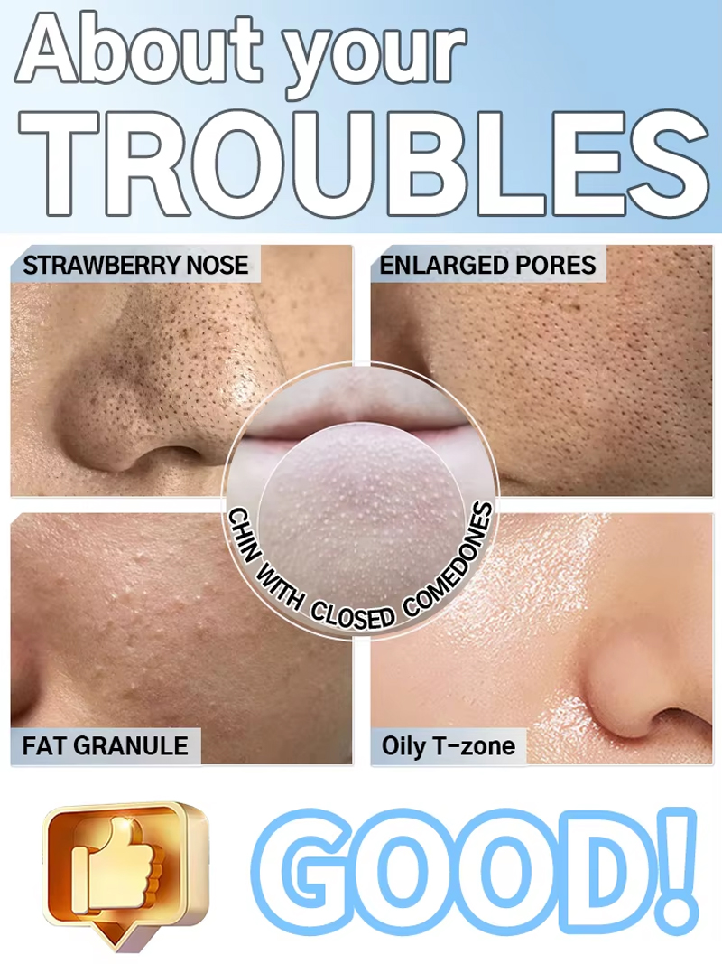 Blackhead Remover Vacuum Pore  - Pore Vacuum review and price