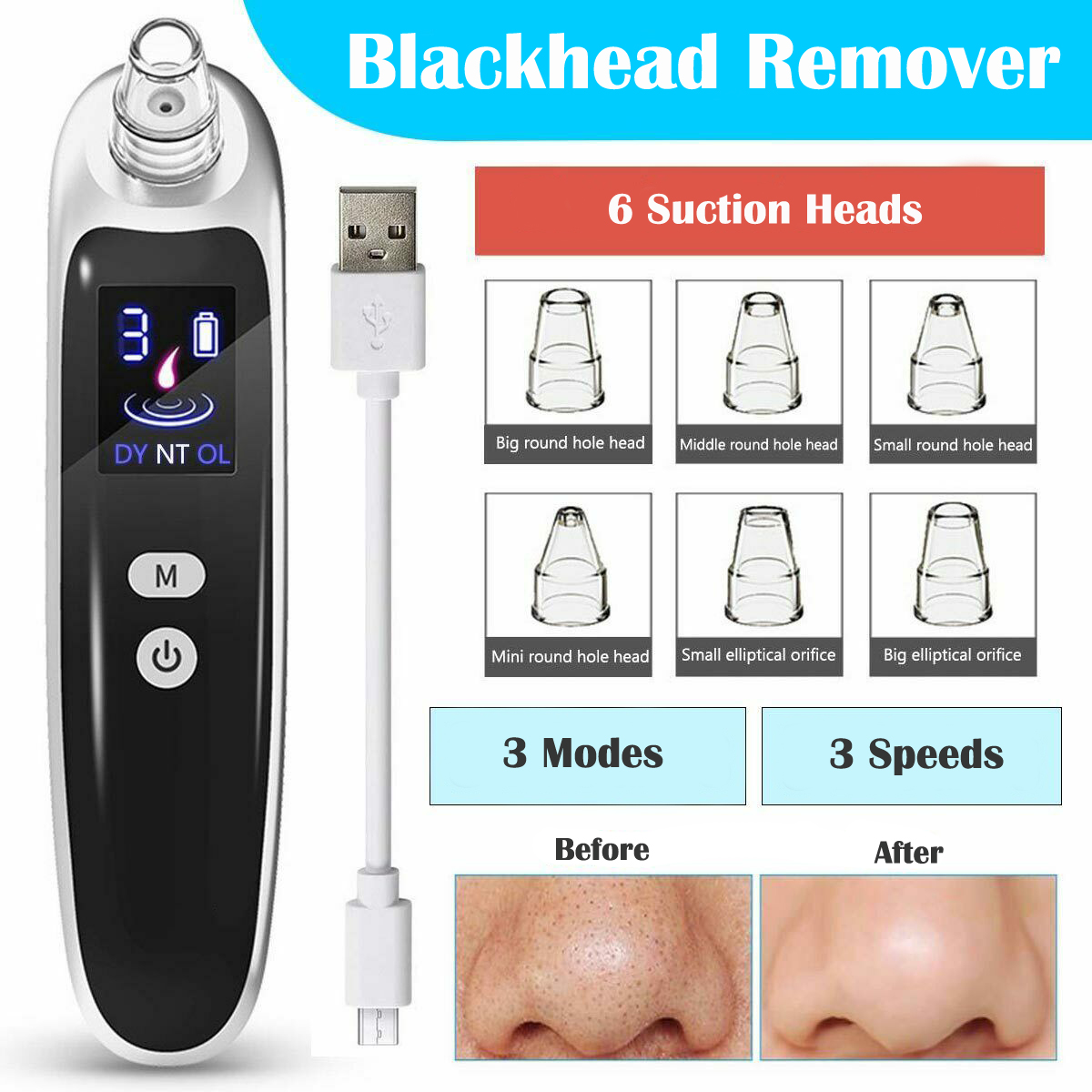 Electric Blackhead Remover Dee - Pore Vacuum review and price