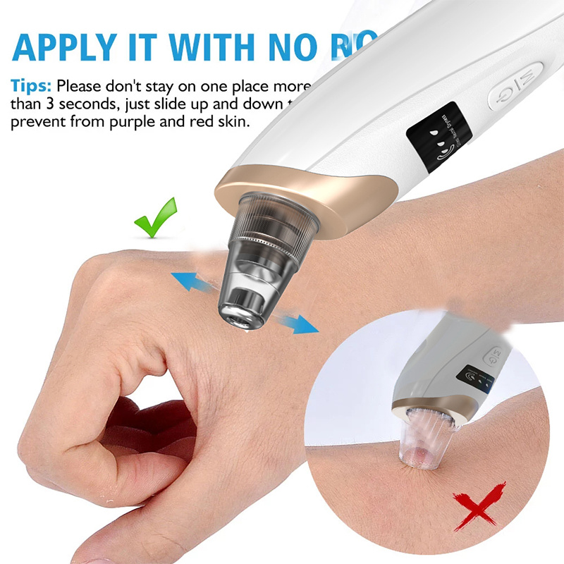 Blackhead Remover Pimples and  - Pore Vacuum review and price